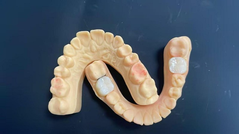 Kaj je ramenski rob?