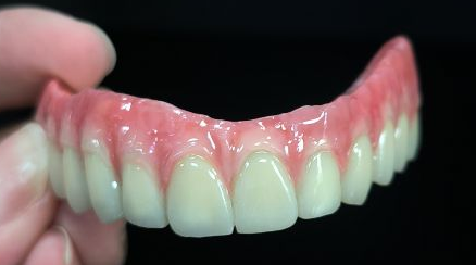 Vse na 4 Hybrid - Malo Bridge Full Circonia krone nad titanovo strukturo